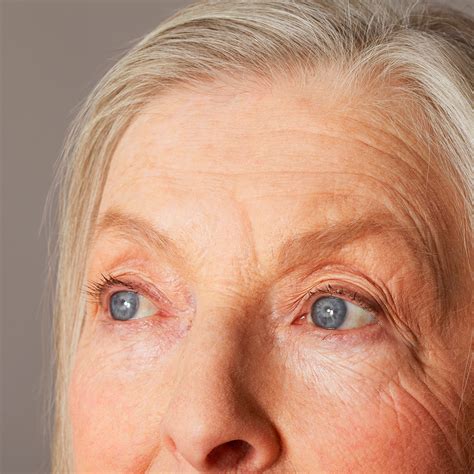 forehead wrinkles    lot   health