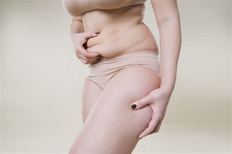 Resuming Exercise And Sex After A Tummy Tuck