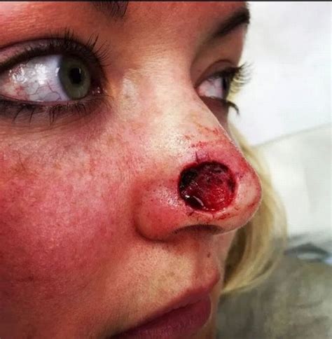 women show disfigured lips gruesome scars and holes in