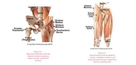 Lateral Hip Pain Side