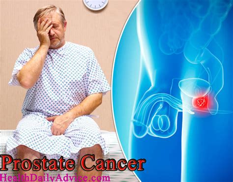How To Detect Prostate Cancer Early Signs Of Prostate Cancer