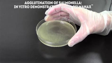 agglutination  salmonella  vitro demonstration  celmanax