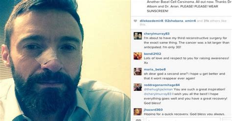 Hugh Jackman Reveals Skin Cancer Scare Daily Star