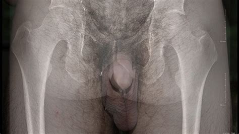 More Than Skin Deep An X Ray View Of My Dick Xxx Mobile Porno