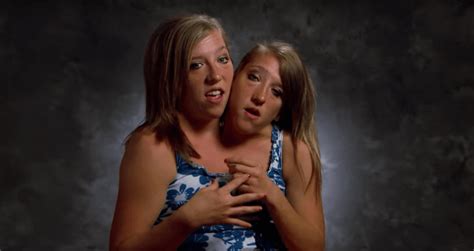 The Incredible Story Of Conjoined Twins Abby And Brittany Hensel [video]