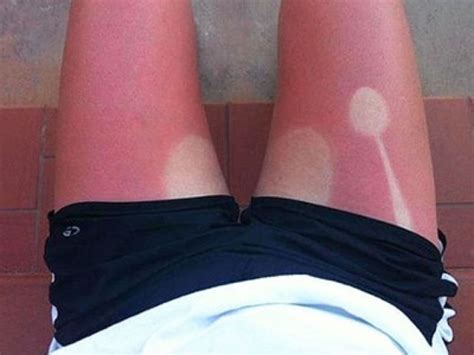 10 Hilarious Examples Of Sun Tans Gone Very Wrong
