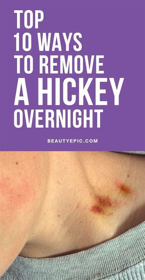 pin by harry63rux on home remedies hickeys how to hide hickeys get