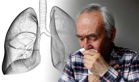 Lung Cancer Symptoms The Common Illness In Asthmatics That May Signal