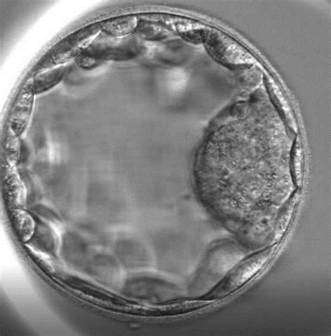 blastocist embrion de cinci zile europe ivf