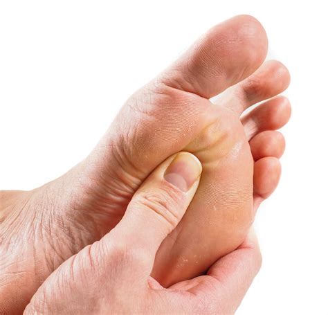 What Is A Diabetic Foot Ulcer Martin Foot And Ankle