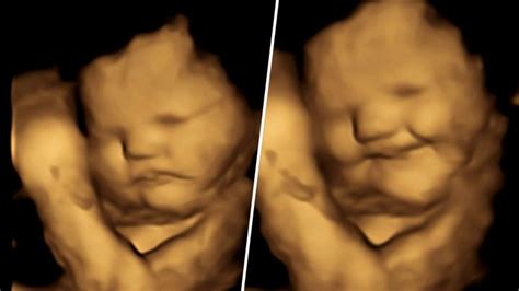 baby ultrasound images show fetus  reaction  flavors
