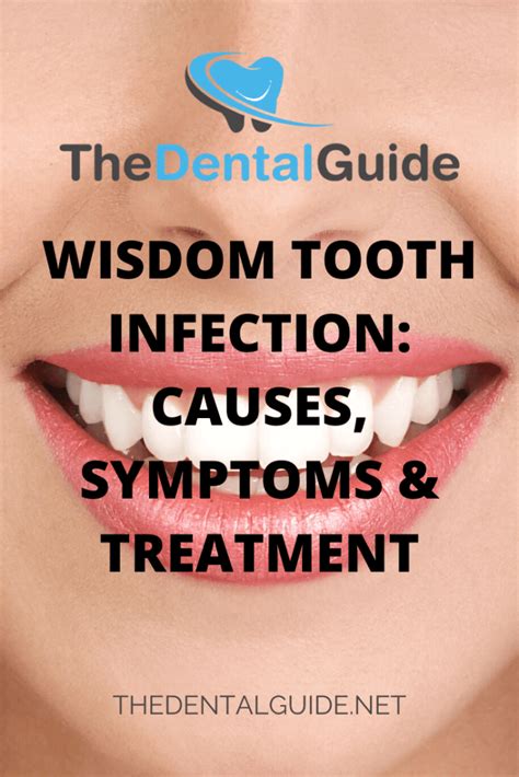 wisdom tooth infection  symptoms treatment  dental guide usa