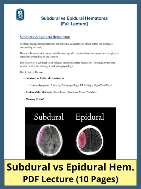 subdural  epidural hematoma  symptoms  ct radiology