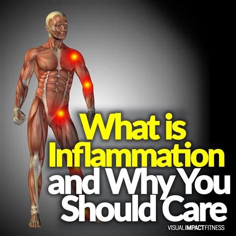 inflammation    care muscle inflammation inflammation inflammation