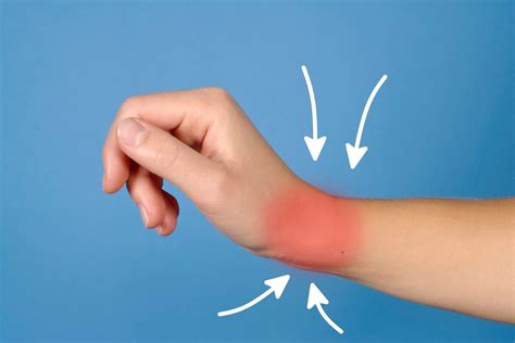 tips  reducing pain   wrist injury occurs fitneass