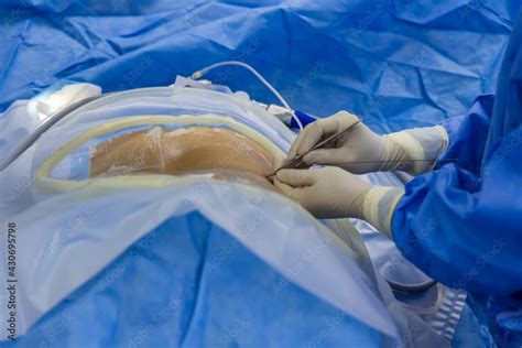 surgeon  blue surgical gown uniform  incision  insert