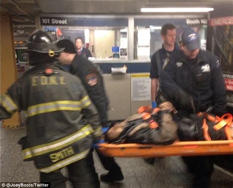 Middle Aged Man Has Both His Legs Sliced Off By Saturday Night New York