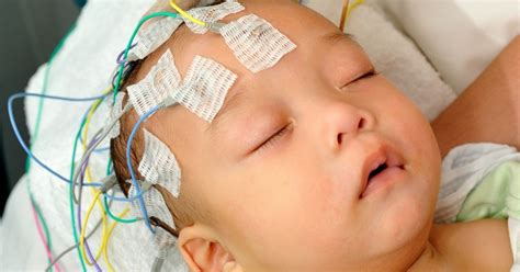 hypoxic ischemic encephalopathy child neurology foundation