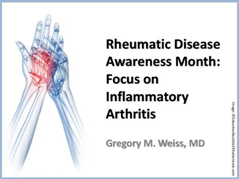 rheumatic disease awareness month focus  inflammatory arthritis rheumatology network
