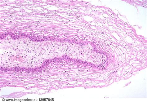 labia minora lm labia minora lm female female reproductive system