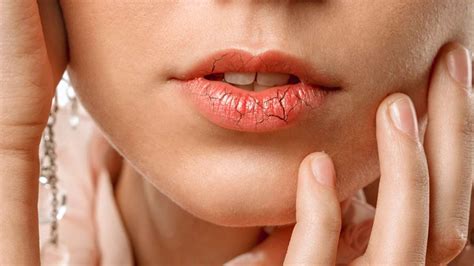 Tips Merawat Bibir Kering Secara Alami Dan Efektif
