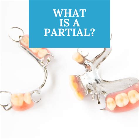 partial digital denture implants los angeles ca