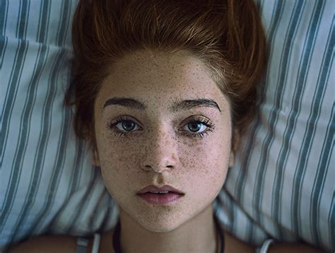 Beautiful Portraits Of Freckled People –