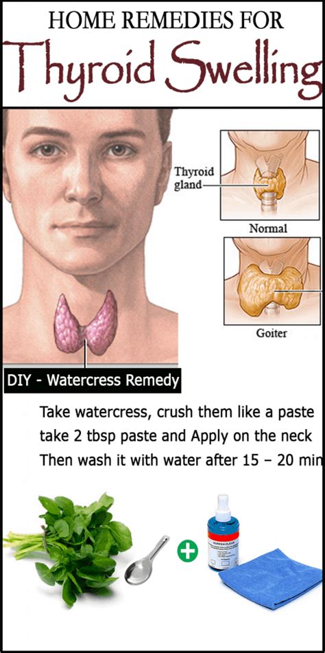 diy remedies  goiter thyroid swelling