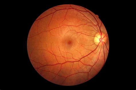 retina  piedmont eye center