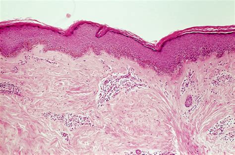 evaluating  classifications  systemic sclerosis rheumatology