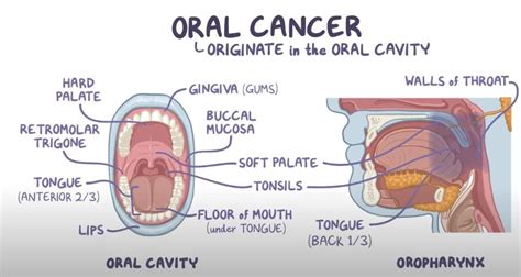 oral cancer symptoms  treatments    tam