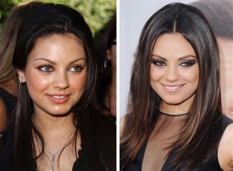 Mila Kunis Nose Job Plastic Surgery Before And After