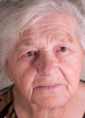 age column  older people treated  depression eleanor