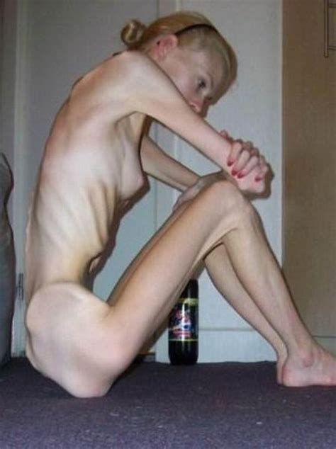 anorexic porn thread nws page 15 yellow bullet forums