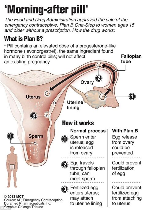 Plan B Contraception Obama S Justice Department Appeals