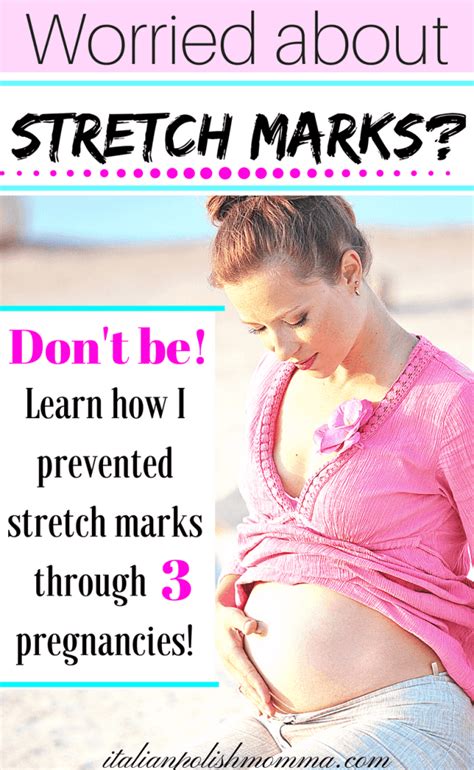 how to prevent stretch marks during pregnancy