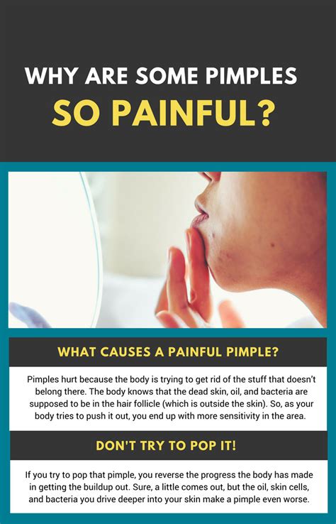 pimples  painful    stop  pain