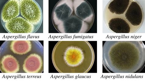 aspergillus morphology clinical features  lab diagnosis microbe