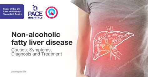 non alcoholic fatty liver disease causes symptoms diagnosis and