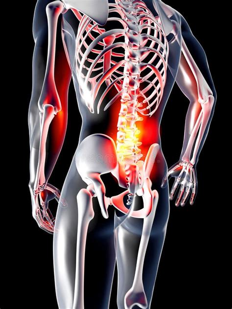 anatomy  pain stock illustration illustration  medical