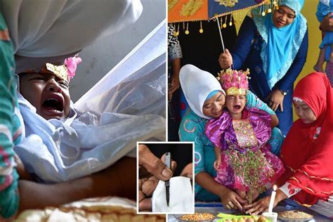 Disturbing Pics Show A Screaming 18 Month Old Girl Getting Circumcised