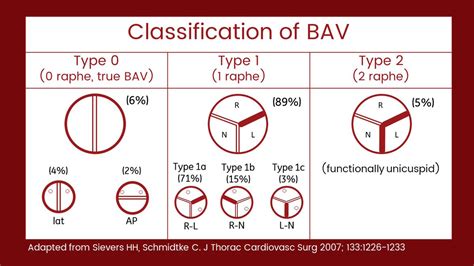 Bicuspid Aortic Valves Bav Occurs In About 1 Of Grepmed
