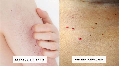 skin rash    red spots  bumps  pictures allure