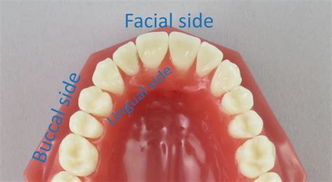 facial buccal lingual side  cavities kuipers ortho