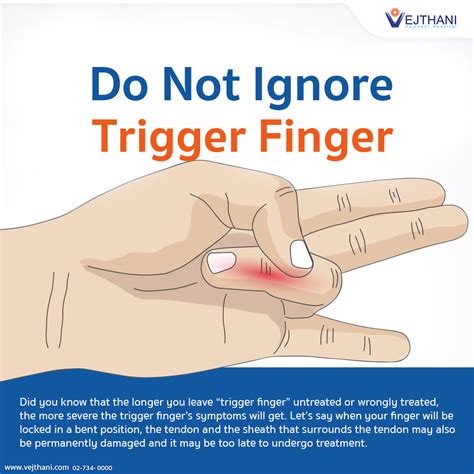 do not ignore trigger finger