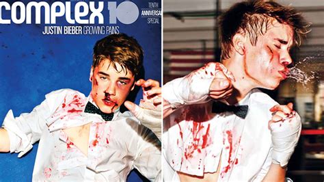 Justin Bieber Gets Beat Up For New Photo Shoot