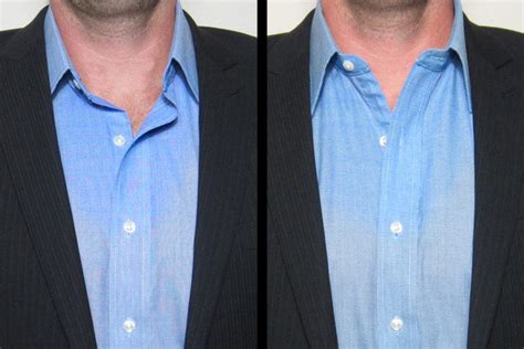 5 Tips To Perfect Looking Shirt Collars Wear Dress Shirts Without A