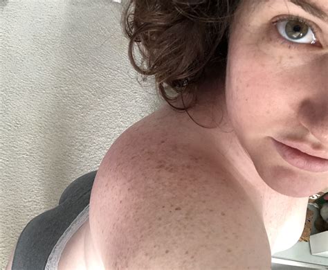 Fresh Face Vacation Freckles Canâ€™t Lose ðŸ˜ Porn Pic
