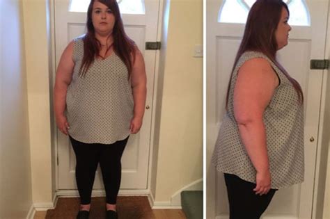 Obese Woman Sheds 12st After Being Too Ashamed For Sex – Look At Her