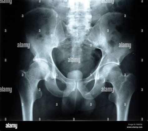 pelvic exam fotos und bildmaterial  hoher aufloesung alamy